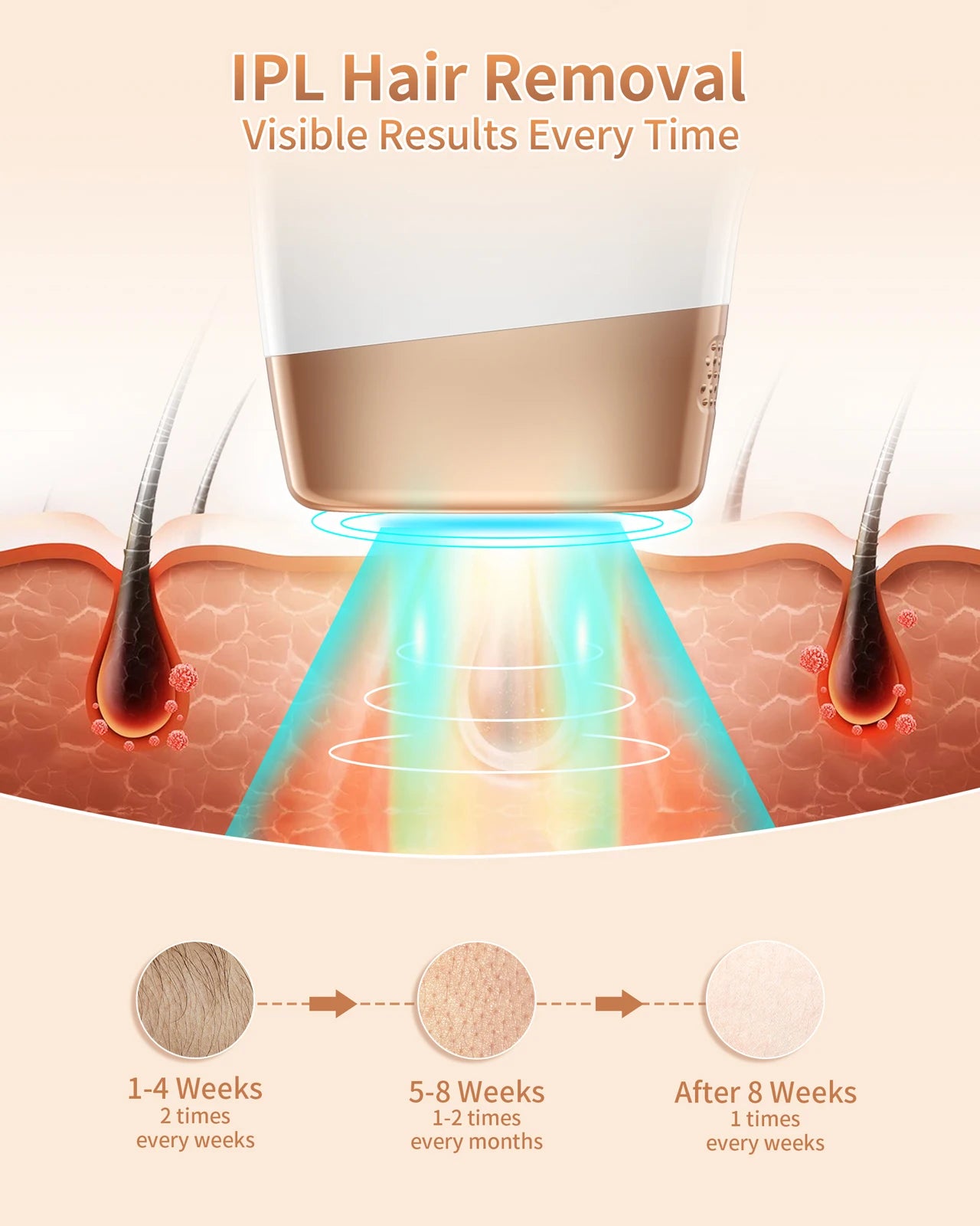 IPL Hair Removal Laser